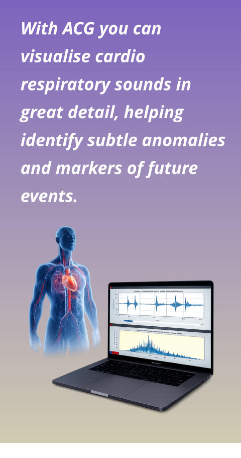With ACG you can visualise cardio respiratory sounds in great detail, helping identify subtle anomalies and markers of future events.